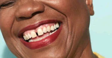 Facts About People With Gap On Their Upper Teeth You Should Know