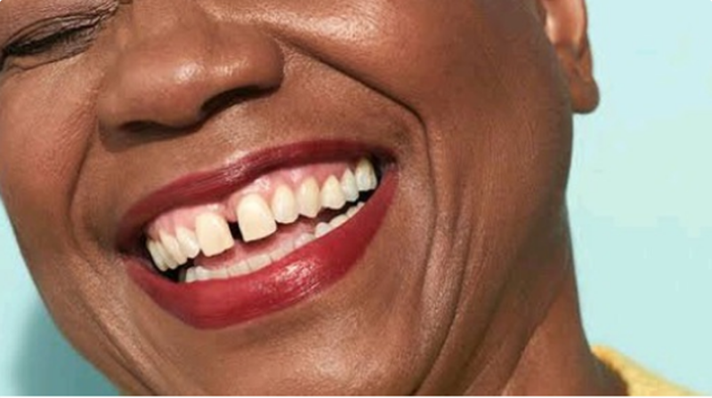 Facts About People With Gap On Their Upper Teeth You Should Know