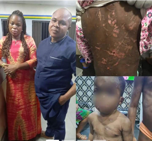 Woman And Her Partner Arrested For Allegedly Battering Her Two Children Photo