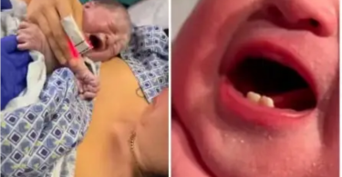 Mystery As Woman Gives Birth To Baby With Teeth