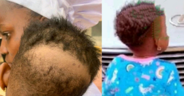 Nigerian mother cries out after her 2-year-old daughter’s hair was scraped in school
