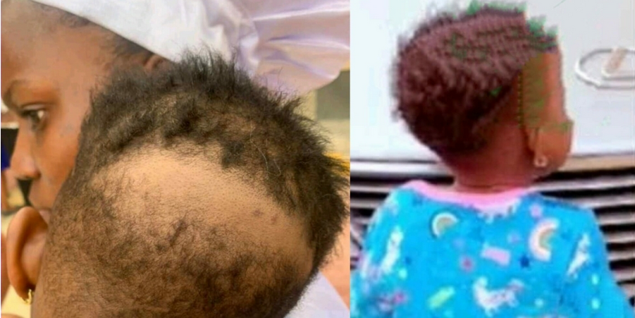 Nigerian mother cries out after her 2-year-old daughter’s hair was scraped in school